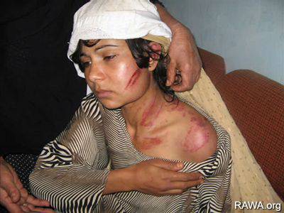 violenza-donne-afghanistan